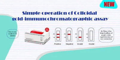 SARS-CoV-2 test antitijela